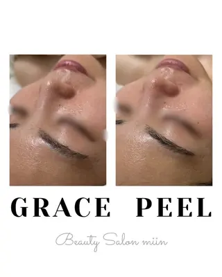 韓国肌管理 白玉肌管理®︎のエステ・リラクイメージ