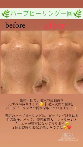 Salon de Lino 御器所のエステ・リラクイメージ