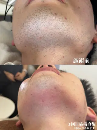 メンズ muumo所属・muumo まりののエステ・リラクイメージ