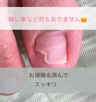 ネイル Chérinail 爪のお手入れのネイルデザイン