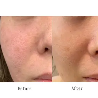 Lavieriche "ラヴィリッシュ"のエステ・リラクイメージ