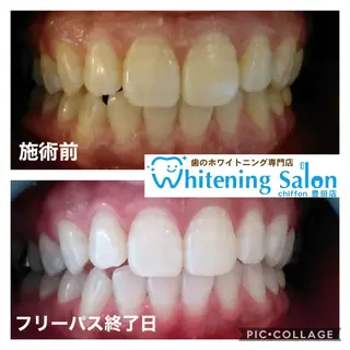 ホワイトニングサロンシフォン豊田店所属・ホワイトニングサロン シフォン豊田店のその他イメージ
