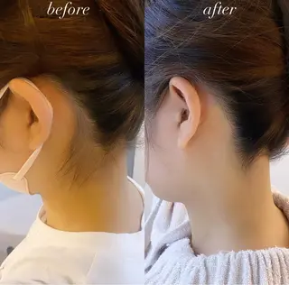 うなじ脱毛/美肌脱毛 LABELのエステ・リラクイメージ