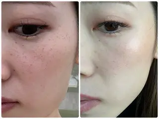 シミ毛穴専門店 yucca(ユッカ)のエステ・リラクイメージ