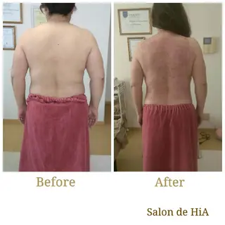 Salon de  HiAのエステ・リラクイメージ