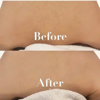 L’Beige レベージュのエステ・リラクイメージ