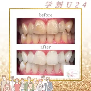 ホワイトニング ショップ本厚木のその他イメージ