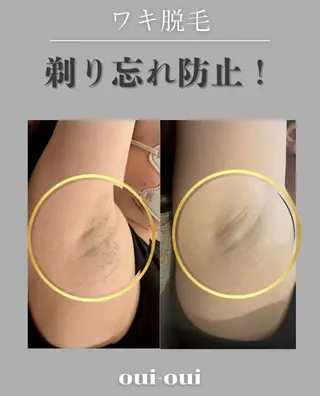 oui-oui　ウィウィ所属・oui-oui 磐田脱毛のエステ・リラクイメージ