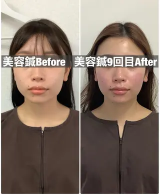 メディカルサロンドオフ所属・ハリサロンドオフ 美容鍼灸×小顔整体のエステ・リラクイメージ