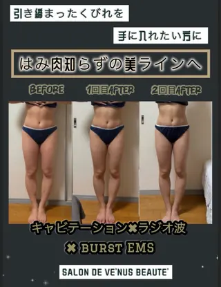 ヴィーナス ビューティーのエステ・リラクイメージ