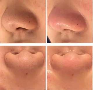 鹿の子台 プライベートサロン 芹花〜SERIKA〜所属・稲角 芹香のエステ・リラクイメージ