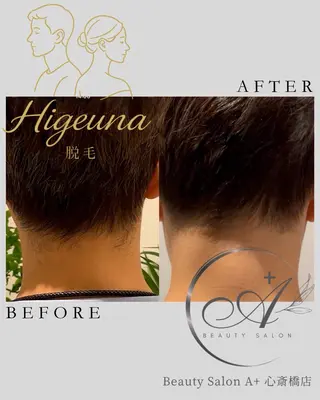 BeautysalonA所属・うなじ脱毛/ つや肌ハーブのエステ・リラクイメージ