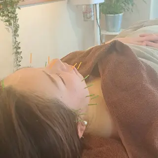 鍼灸サロンmiyabi所属・美容鍼×エステ　鍼灸 サロンmiyabiのエステ・リラクイメージ