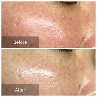 Bène Soin du Esthétique所属・逵中 元香のエステ・リラクイメージ