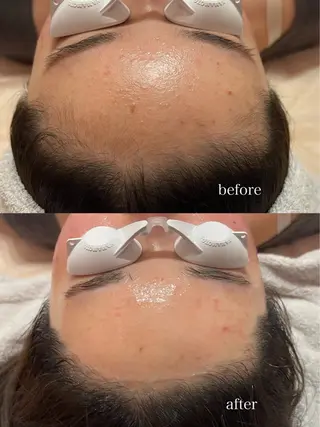 SAERA yuyuのエステ・リラクイメージ