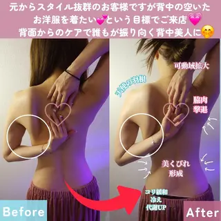 痩身ハーブピーリング 筋膜リリース☆B&Hのエステ・リラクイメージ