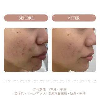 脱毛 Beauty salon Lumiere(ルミエール)所属・完全都度払い脱毛⭐︎ Lumiereのエステ・リラクイメージ