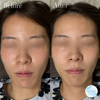 美容鍼脱毛salon リノン吹田駅前店のエステ・リラクイメージ