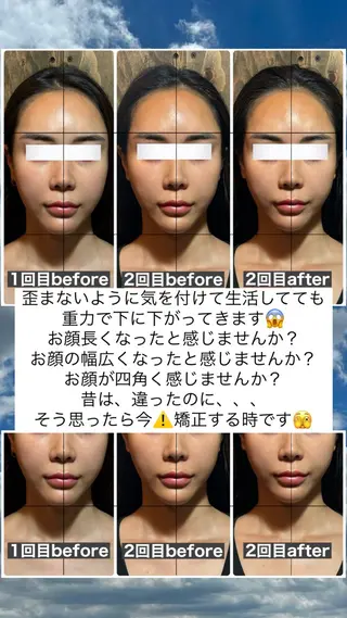 💎後悔させない小顔 矯正💎イトヤマ🌱のエステ・リラクイメージ