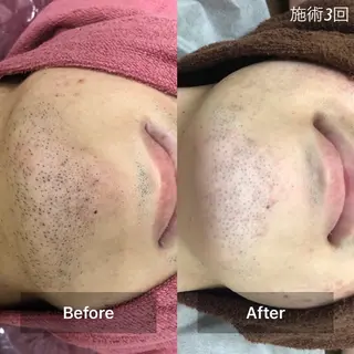 メンズ Mens Salon SOLEのエステ・リラクイメージ