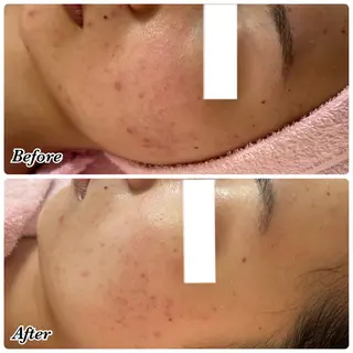 peili (ペイリー)岩田のエステ・リラクイメージ