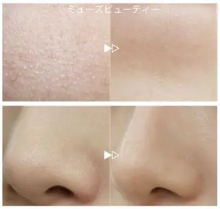 メンズ ミューズビューティー所属・山本 ゆりのエステ・リラクイメージ