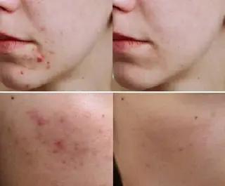 全身脱毛&VIO脱毛 紹介率№1♪リナ♪のエステ・リラクイメージ