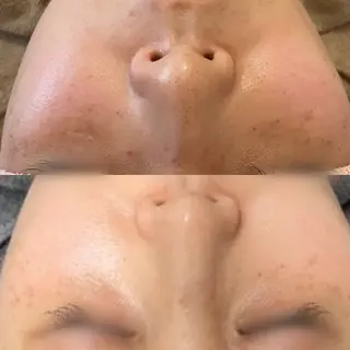 シミケア専門サロンL ino所属・シミケア専門サロン Linoのエステ・リラクイメージ