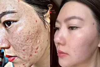 上福岡 らんらんのネイルデザイン