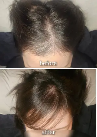 歯科提携セルフダック 宇都宮駒生店のエステ・リラクイメージ