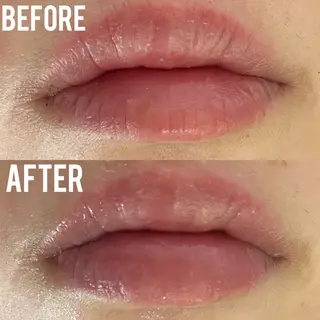 MEITY新宿所属・小顔、毛穴ケア 通い放題エステのエステ・リラクイメージ