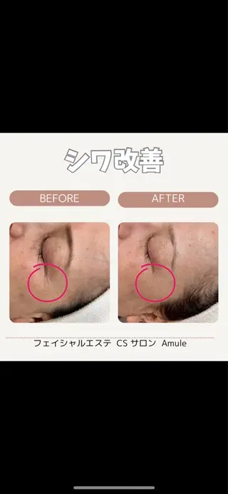 CSサロン Amule所属・🦋肌質改善サロン. anna🦋のエステ・リラクイメージ