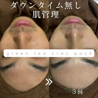美肌salon GRAN CUORE所属・Natsuki🌙 GRAN CUOREのエステ・リラクイメージ