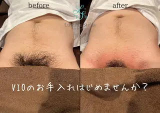 メンズ LuminaStella所属・VIO脱毛＆SPA ルミナステラのエステ・リラクイメージ