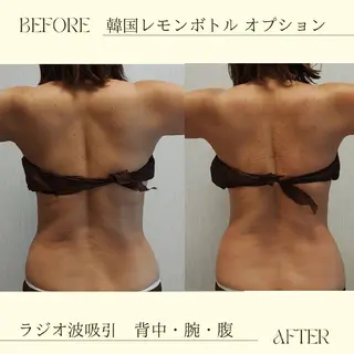 痩身小顔専門 アマテ ビューティー.Nのエステ・リラクイメージ