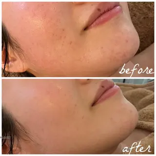 メンズ メナード岐阜市茜部 杉浦のエステ・リラクイメージ