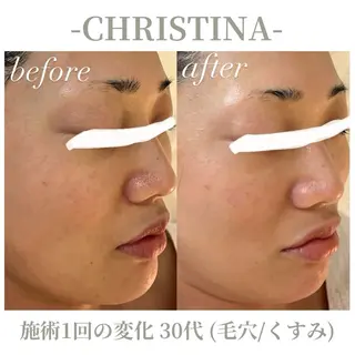 肌質改善|天王寺 For...はるかのエステ・リラクイメージ