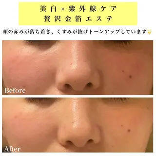 Bellesthe (ベルエステ)のエステ・リラクイメージ