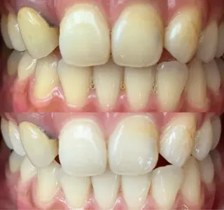 ロング カラー パーマ ヘアアレンジ ネイル マツエク・マツパ アイブロウ LBSホワイトニング 🌐梅田店公式のその他イメージ