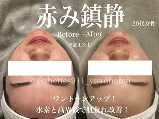 Esthetics 911横浜のエステ・リラクイメージ