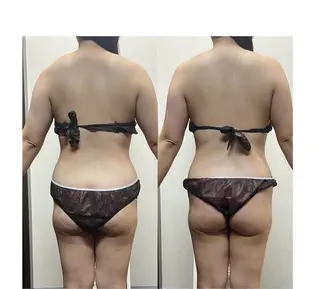 ハイパーナイフ専門店　Salon de COCO所属・Salon de COCOのエステ・リラクイメージ