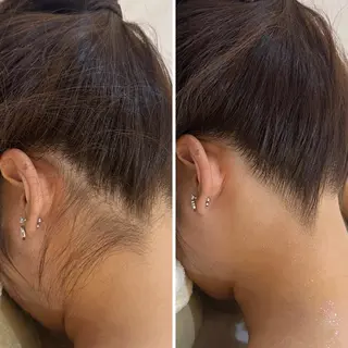 うなじ脱毛/美肌脱毛 LABELのエステ・リラクイメージ