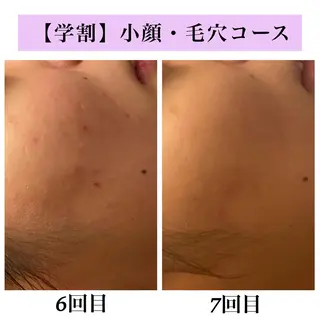 Bellesthe （ベルエステ）のエステ・リラクイメージ