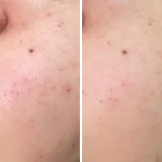 温活未病ケアサロン CoQのエステ・リラクイメージ