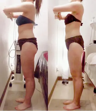 痩身・小顔・脱毛 グレイスボディのエステ・リラクイメージ