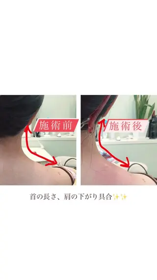 肩首こり×痩身×浄化 🌿リンパエステのエステ・リラクイメージ