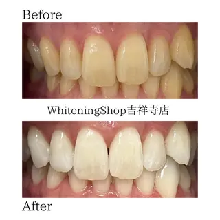 ホワイトニング ショップ吉祥寺店のエステ・リラクイメージ