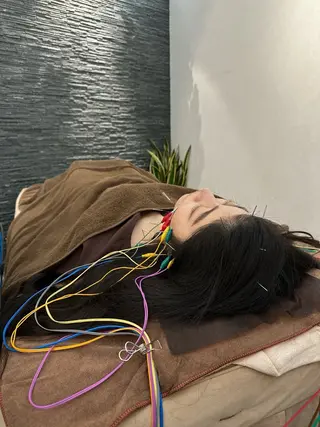 美容鍼灸整体サロンBeauJu所属・小顔矯/美容鍼/鍼灸 BeauJuのその他イメージ