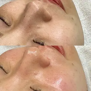 Lei beauty salon所属・松ヤニワックス専門/ 梅田/Leiのエステ・リラクイメージ