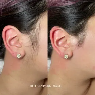 HOTEL&PARK . ワックス脱毛のエステ・リラクイメージ